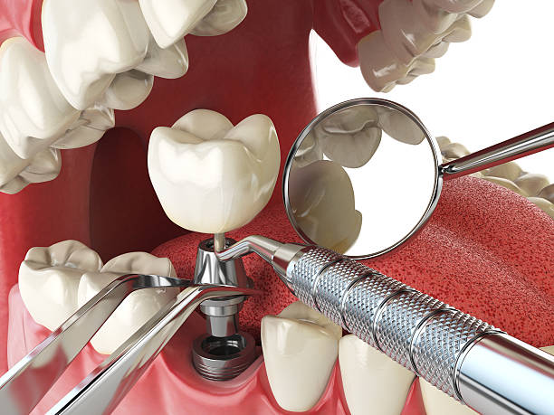 Best Emergency Dental Care for Abscessed Tooth in Fairforest, SC